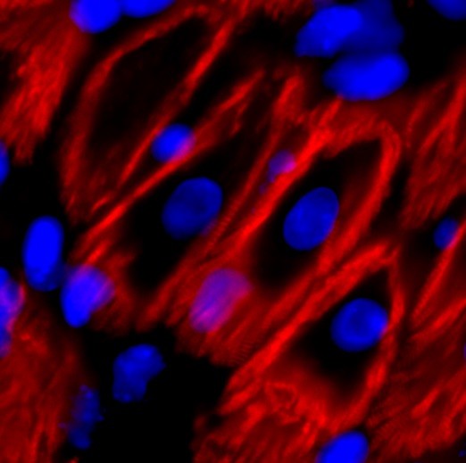 Adult heart cells in mice with two genes deleted showed improved regeneration