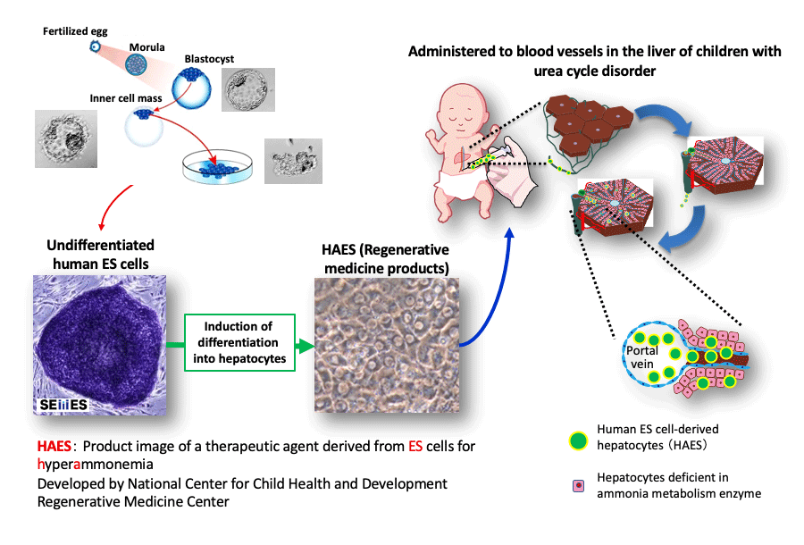 A diagram demonstrating the procedure in the new clinical trial