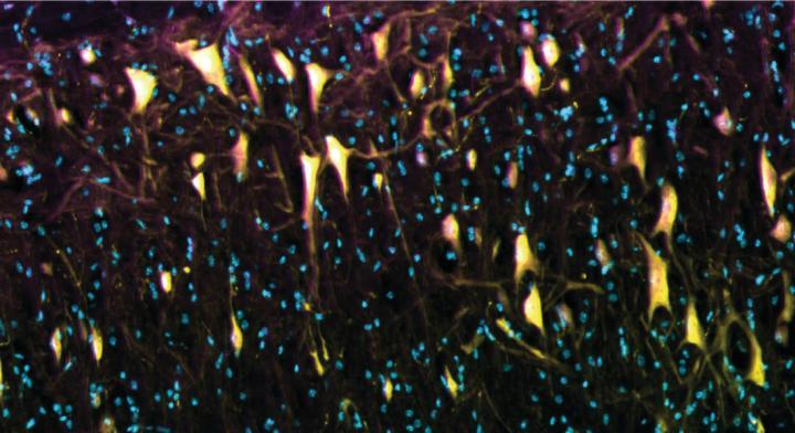 The image shows the compound Tat-P4-(C5)2 after an injection into the spinal cord. The compound (purple) penetrates the nerve cells of the spinal cord (yellow), but not the surrounding cells (the cell nuclei are blue).