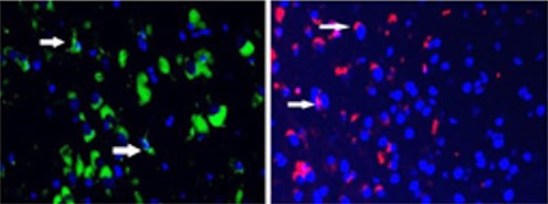 In neurodegenerative mouse brains, harmful cells highlighted in green (left) disappeared on treatment with the drug SDV1a and therapeutic stem cells highlighted in red (right)