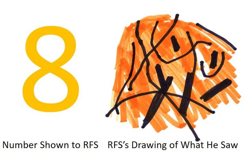 Looking at any digit between 2 and 8, patient RFS could only see a spaghetti-like scramble of lines and colors, as depicted here