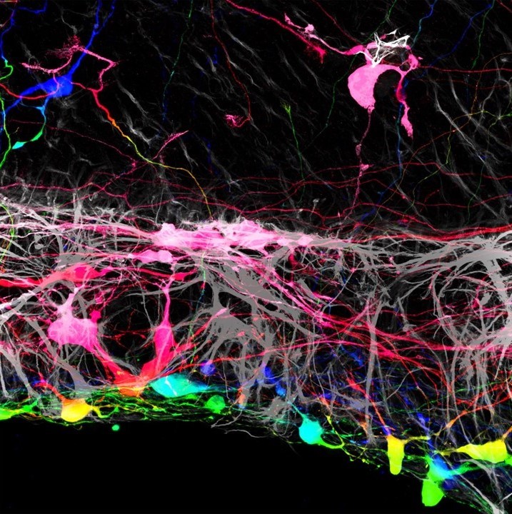 Transplanted retinal ganglion cells, marked with fluorescent tags to track their migration