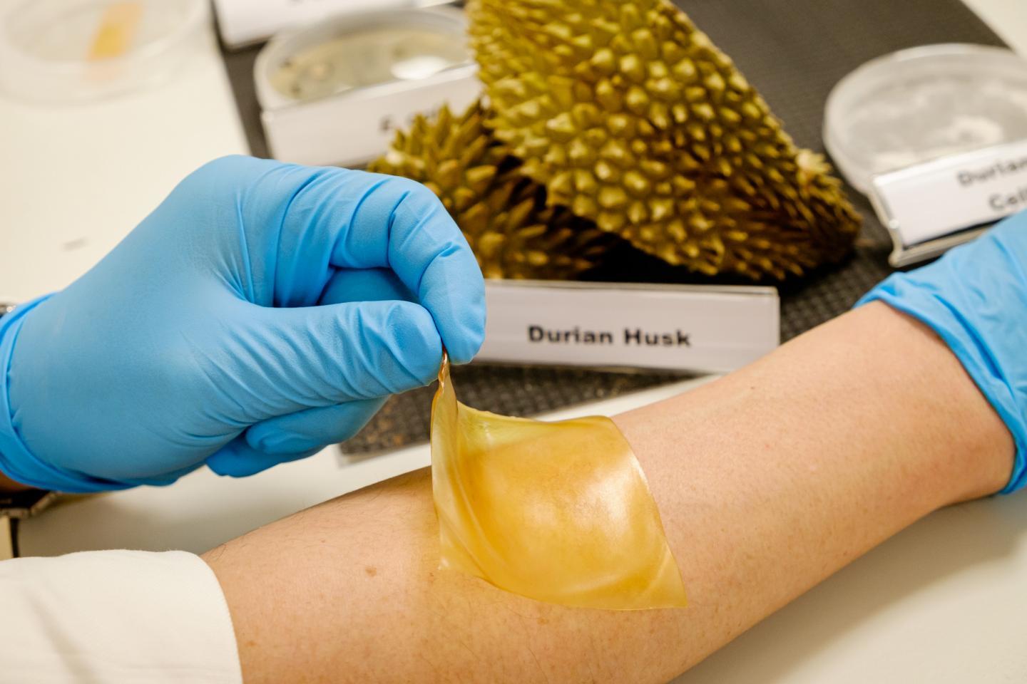 Like other hydrogel dressings, this one is applied directly to the skin