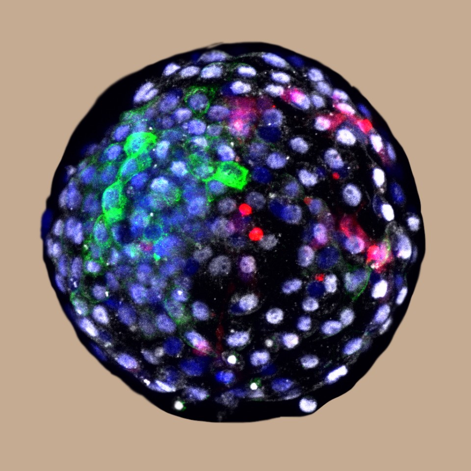 A human-monkey chimera blastocyst