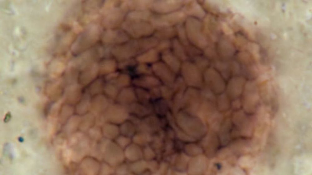 A microscope image of the spherical fossil of Bicellum Brasieri, a holozoa that contains two distinct cell types