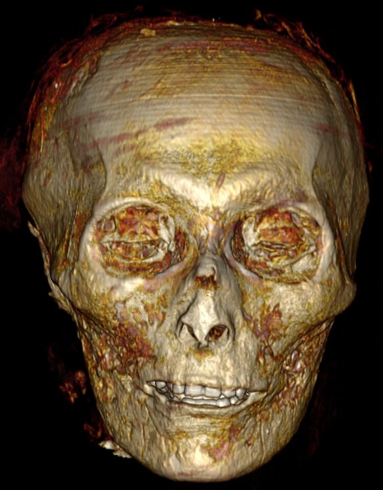 A close-up view of the pharaoh's skull