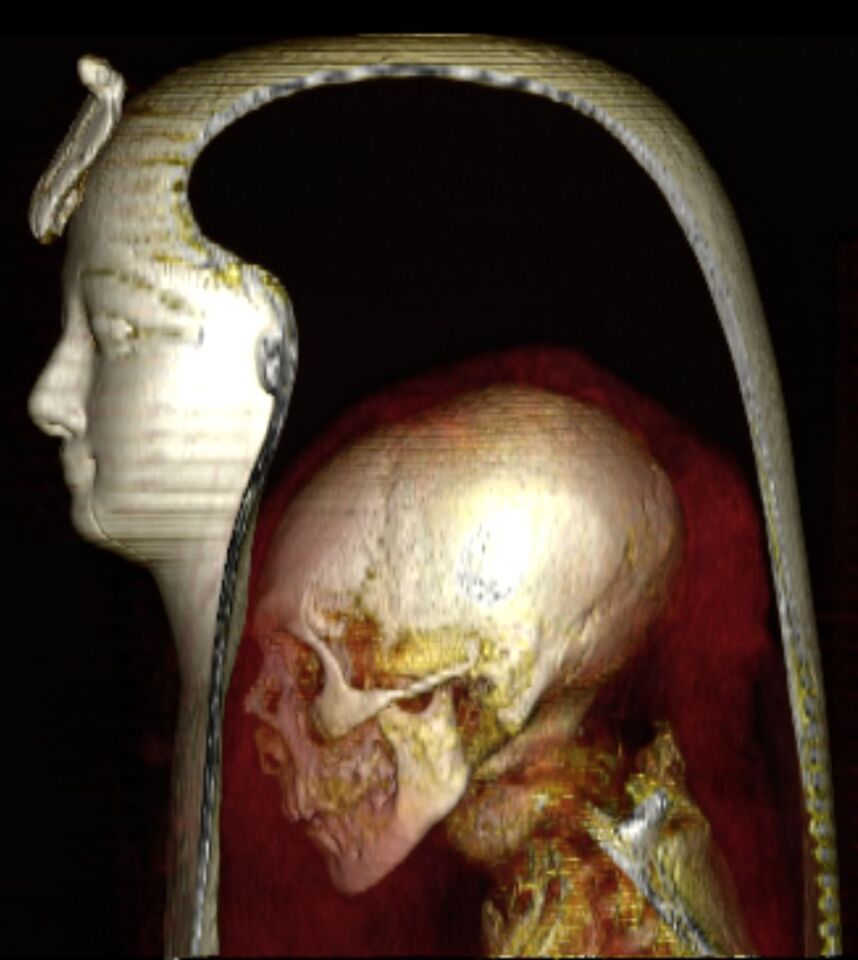 The pharaoh's mummy, showing his shrunken skull and skeleton within the bandages
