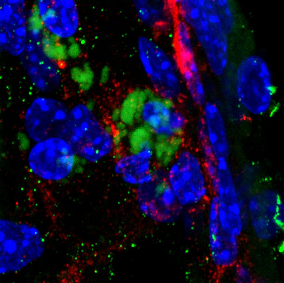 A microscope image of the olfactory bulb in the brain of a mouse – blue indicates brain cells, green indicates Chlamydia pneumoniae bacteria, and red indicates beta amyloid plaques