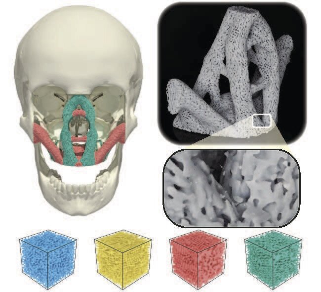 Scientists have used a new material architecture modeled on bone and wood to design new facial implants and aircraft parts