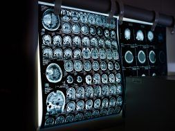 x-ray-6841384_1280