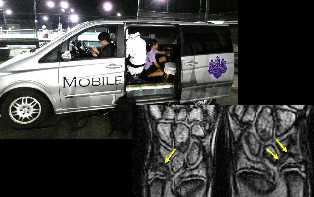 A tennis student gets their wrist scanned by the mobile MRI system