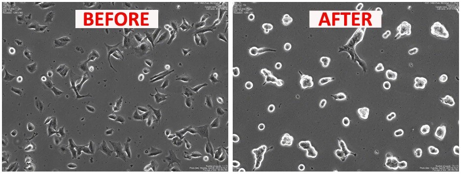 A before and after comparison of the action of the new peptide, Rb4, on melanoma cells