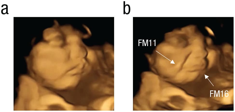From baseline, on the left, to the response when a mother consumed kale