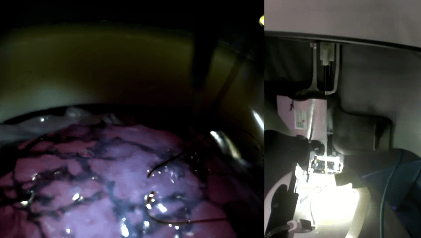 The R1 robot performed a live demonstration, poking 64 threads into a "brain proxy" in 15 minutes