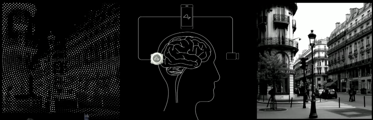 Visual cortex stimulation could give an (initially crude) sense of sight to people who have been blind since birth