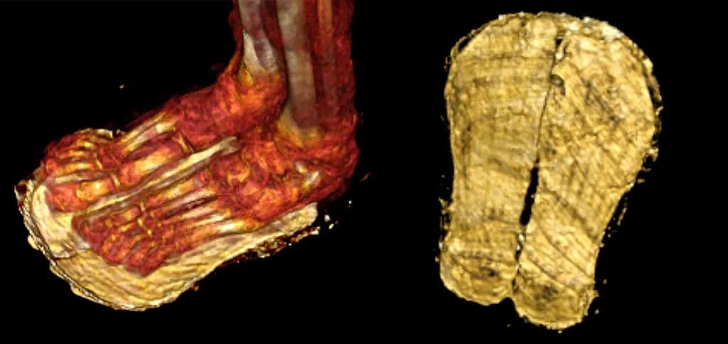 A close-up of the boy's sandals