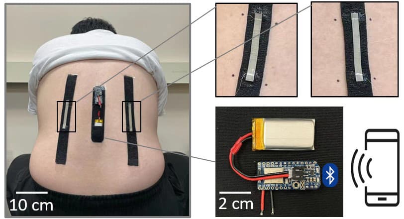 One of the sensors was incorporated into this back-mounted motion-tracking device