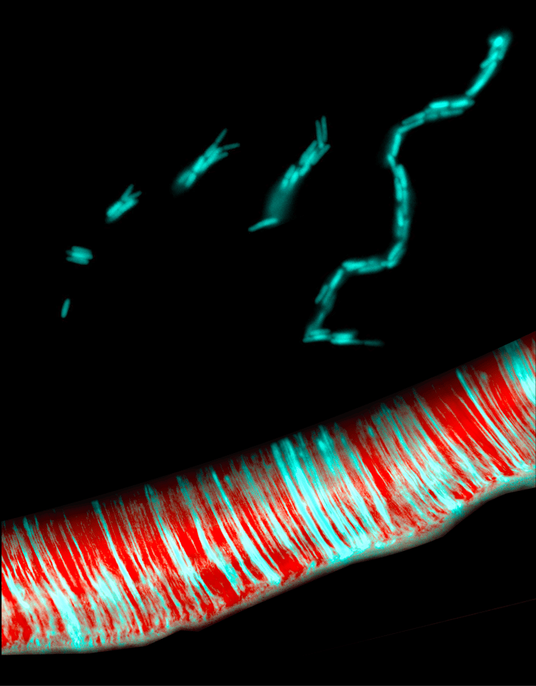 E. coli under the microscope, showing rosettes forming chains (top) and parallel chains forming biofilms (bottom)