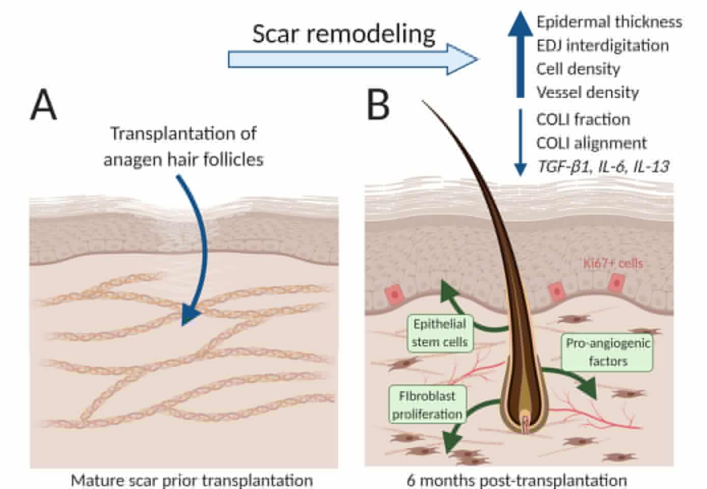 The treated scars harbored new cells and blood vessels, restored healthy collagen patterns, and even expressed genes found in healthy unscarred skin