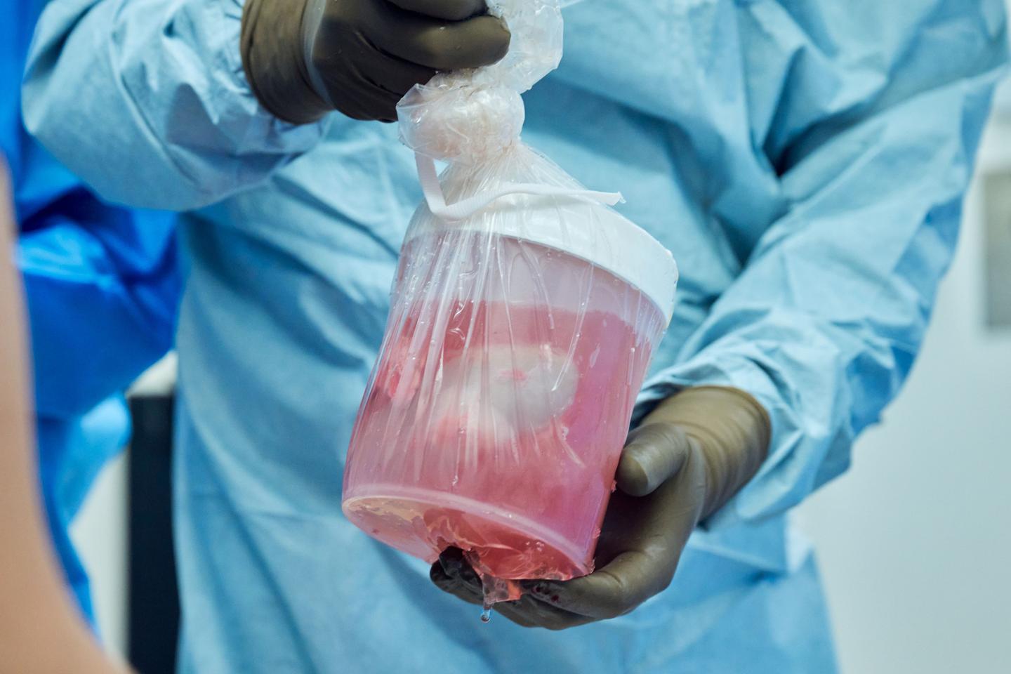Pig Kidney being transported