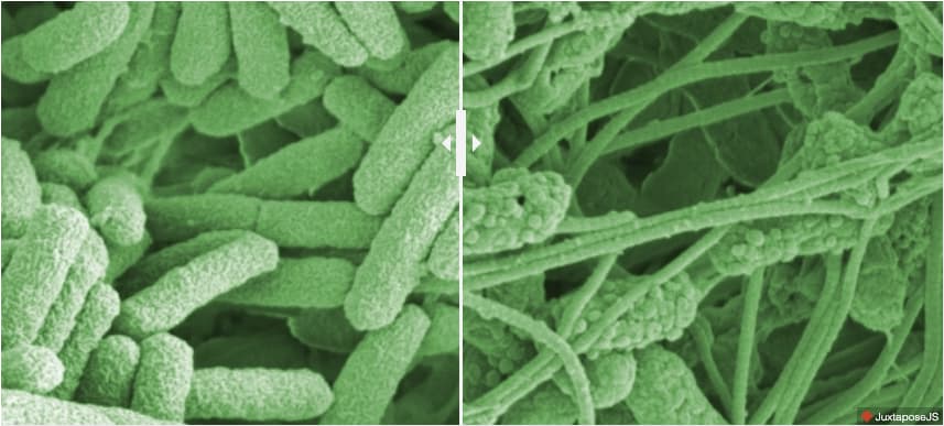 Pseudomonas aeruginosa bacteria in a chronic wound site before (left) and after application of the dressing