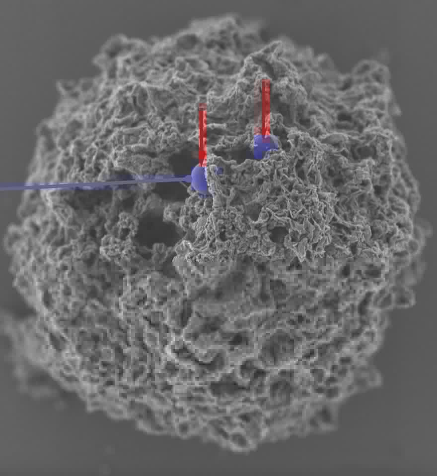 Scanning electron microscopy (SEM) image of the nanoparticles (colorized in purple) inside a mast cell