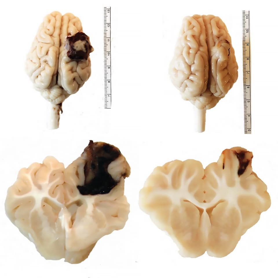 Pig brains before (left) and after treatment (right) with backpack-macrophages, which dramatically reduced the size of a lesion caused by TBI