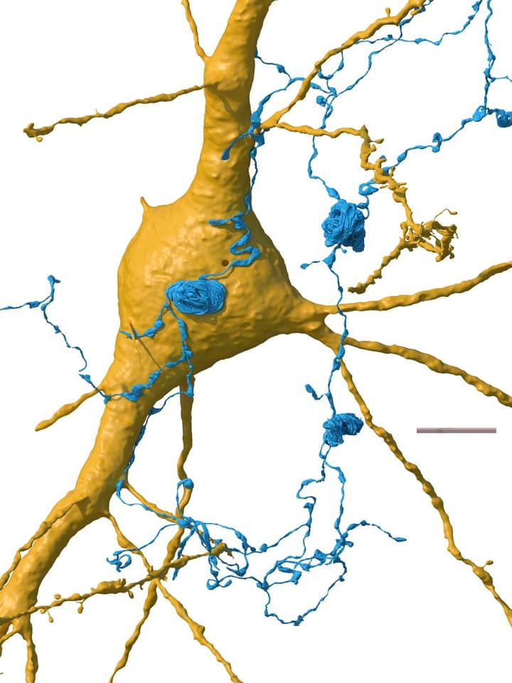 Axon whorls can be seen in blue, forming strange loops that sometimes sat on the surface of other neurons