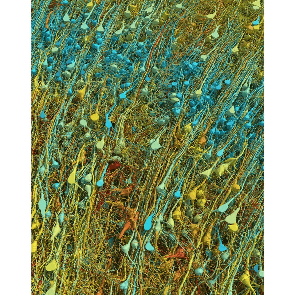 A close up image of neurons