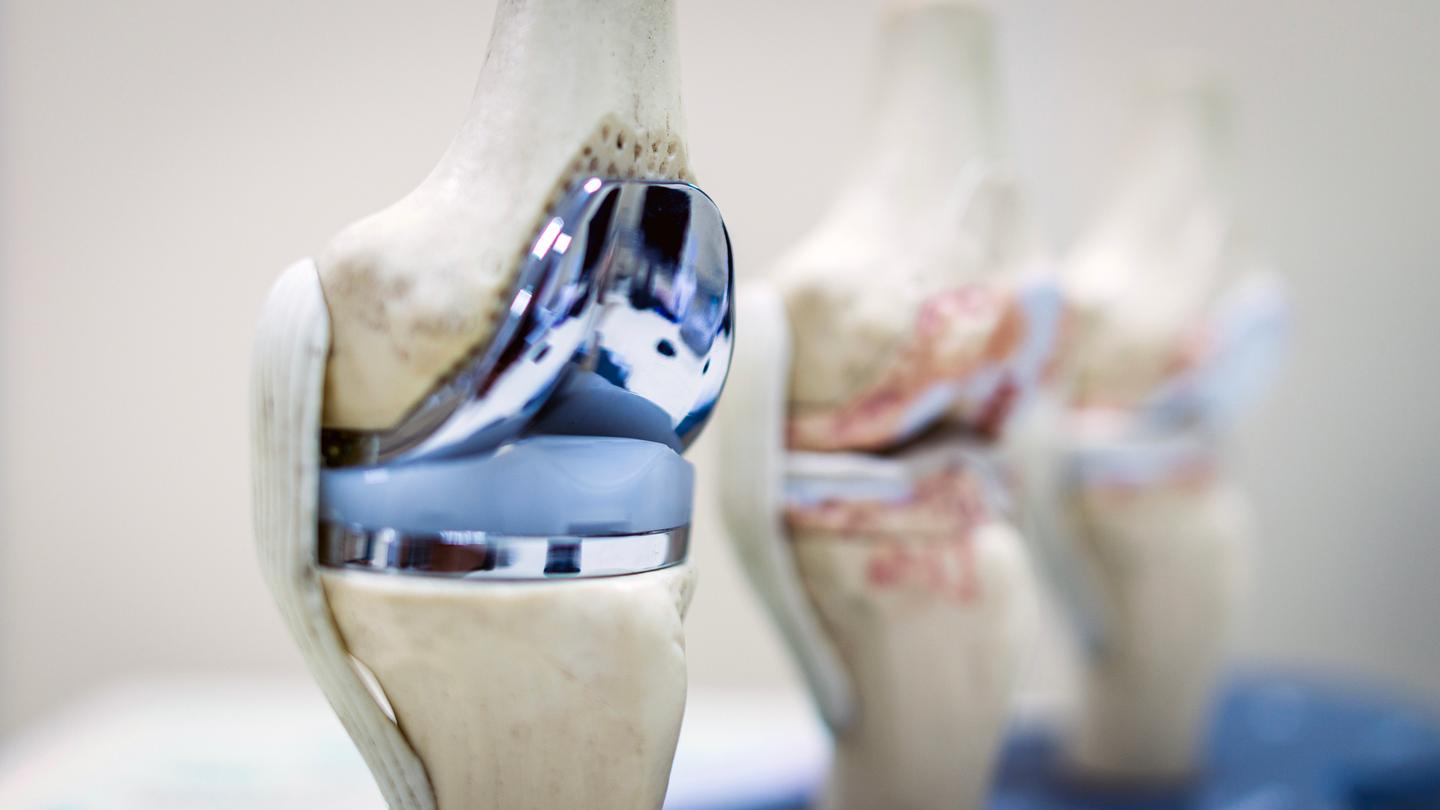 Mock-up of a total knee replacement showing the metal components and plastic spacer