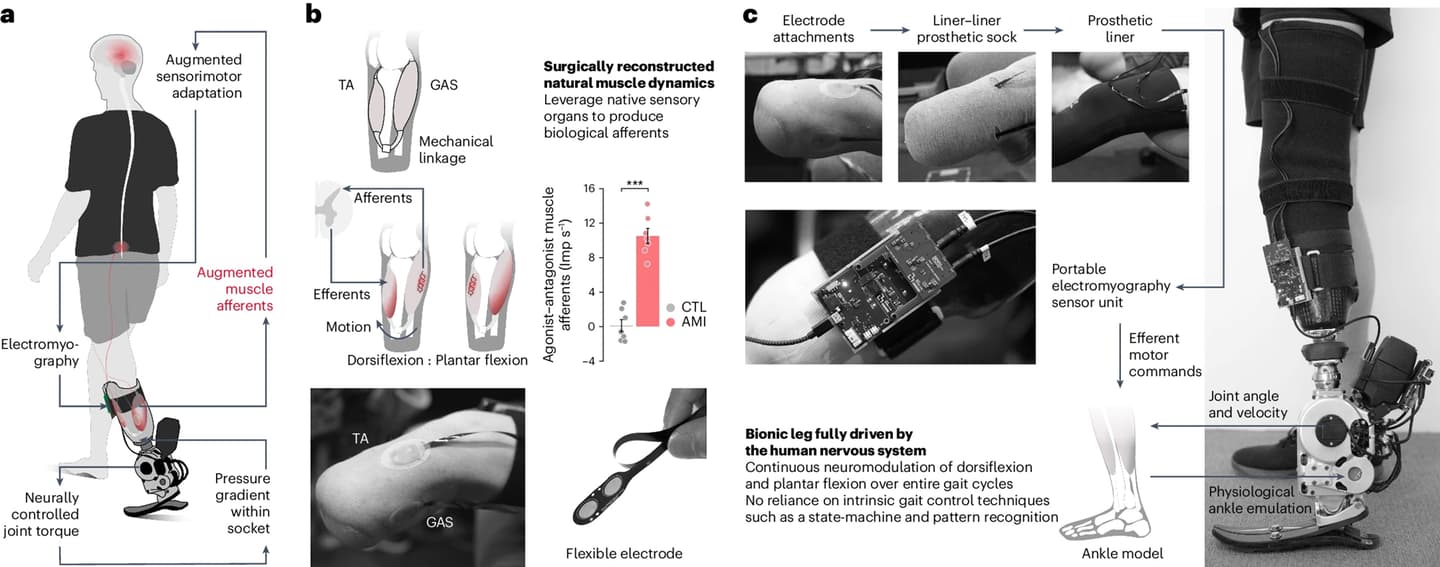 How the bionic prosthesis interacts with the surgically reconstructed lower leg muscles