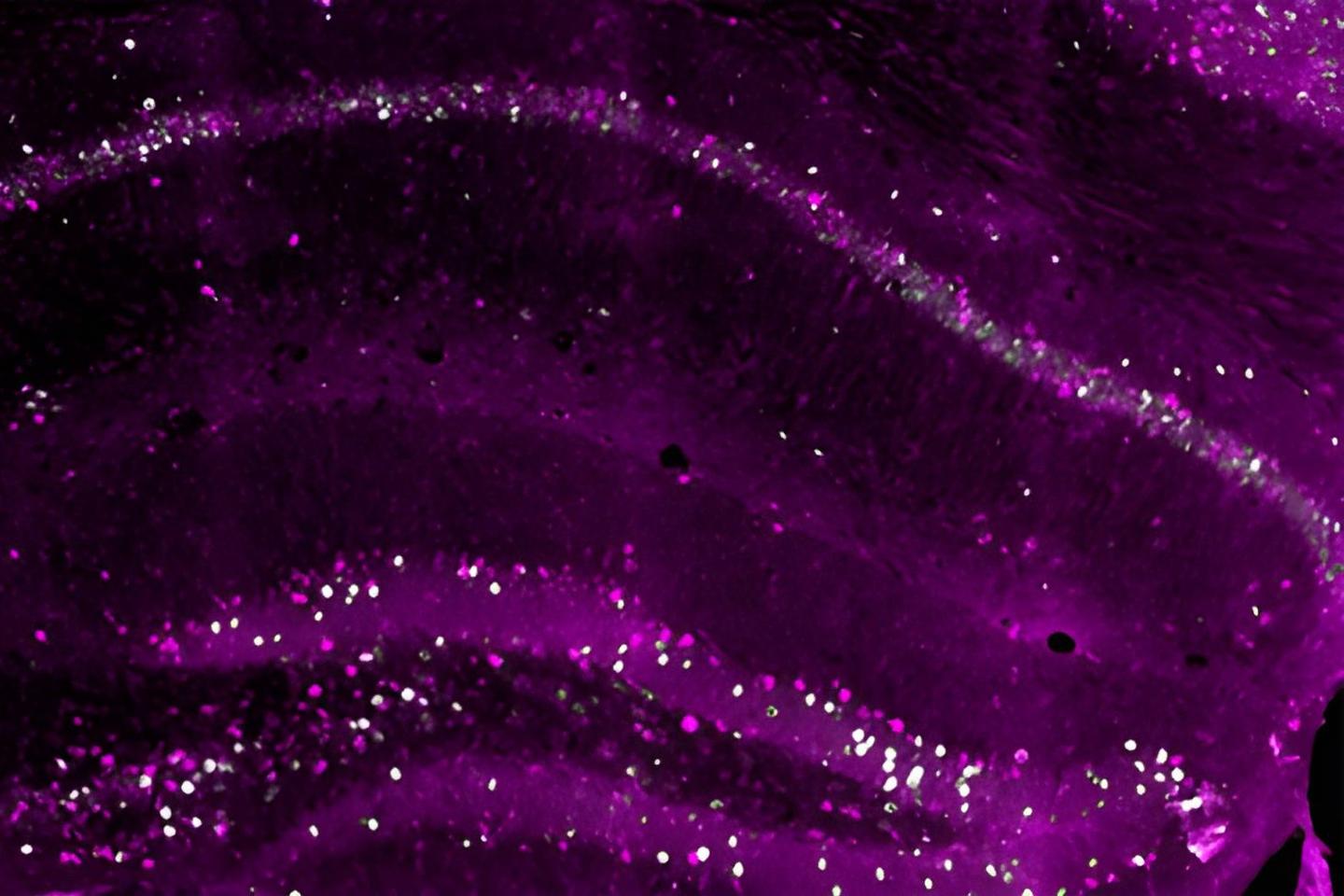 This cross-section of a mouse's hippocampus shows the early-born neurons in magenta, which are responsible for creating a long-lasting copy of a memory