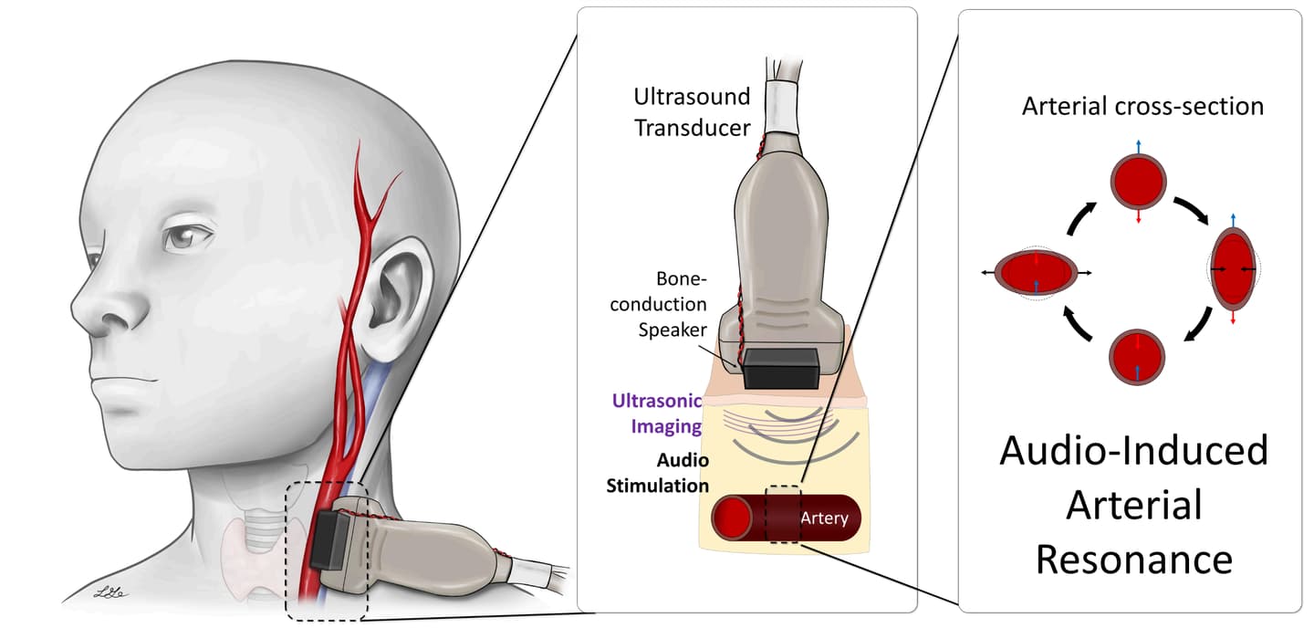 This diagram illustrates the underlying principle behind the resonance sonomanometry system