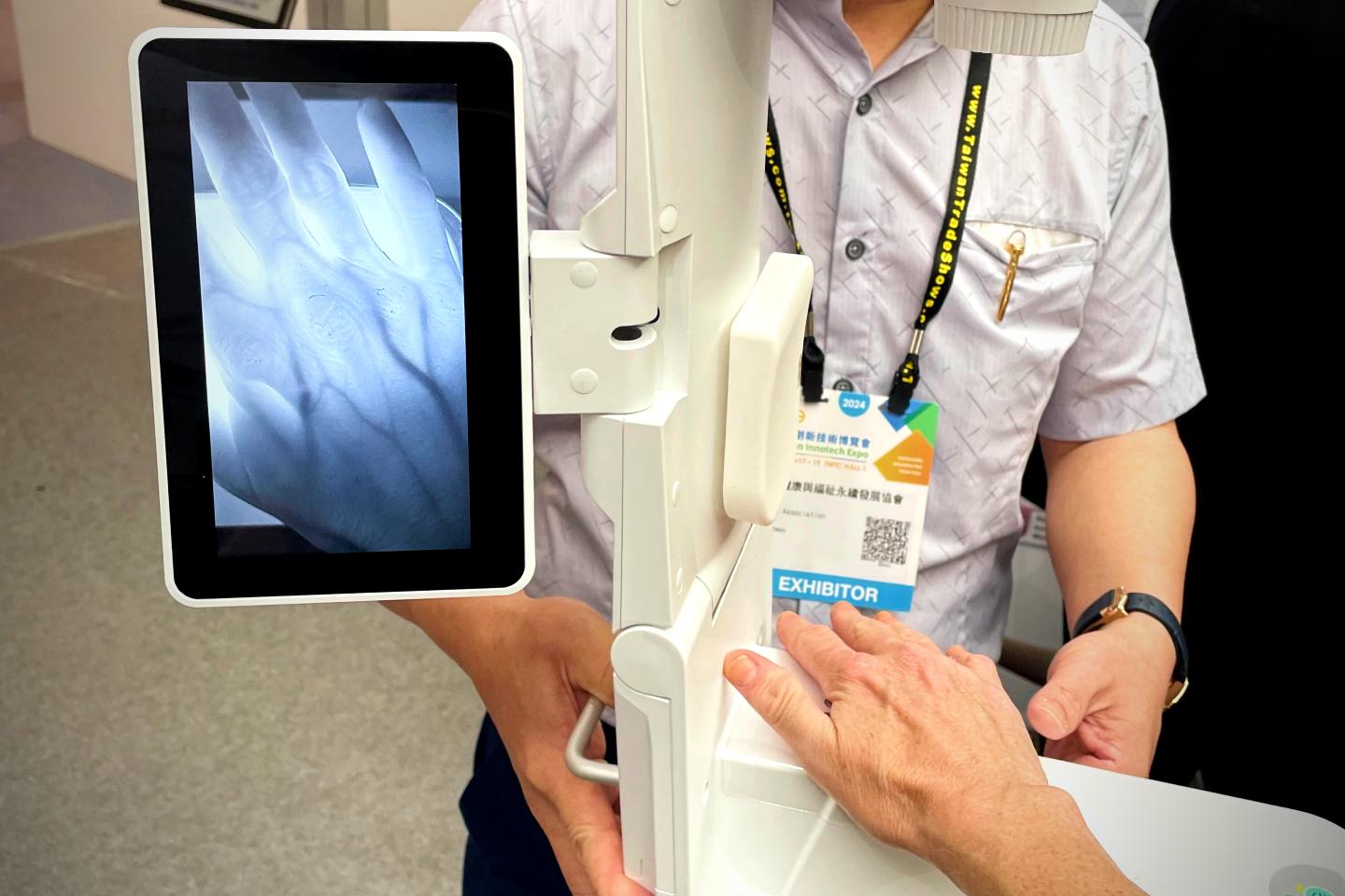New Atlas journalist Bronwyn Thompson gives the vein viewer a try at the InnoTech Conference being held this week in Taipei