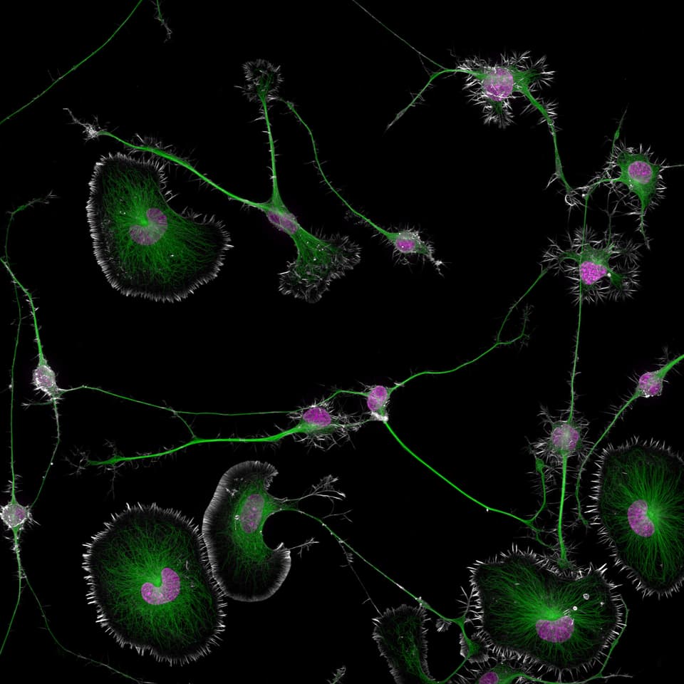 1st place: Differentiated mouse brain tumor cells (actin, microtubules, and nuclei)