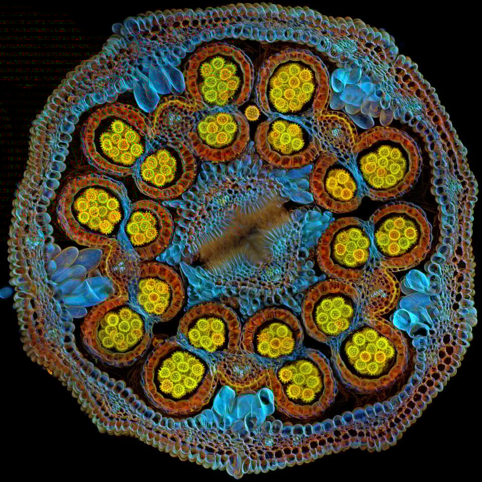 Global Winner: "Beauty of Cosmic Proportions." Cross-section of a Cosmic Orange aster flower with pollen grains maturing inside anthers.