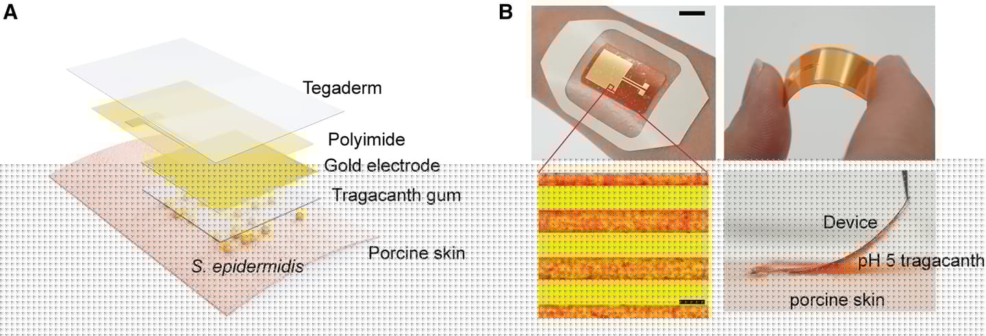 For this study, the bioelectronic patch was applied on pork skin, along with a hydrogel to create an acidic environment for bacterial excitability