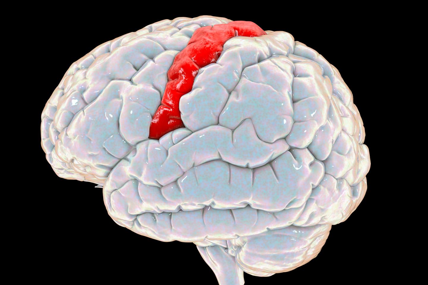 The rTMS treatment was directed at the primary motor cortex (M1) located in the prefrontal cortex (in red)