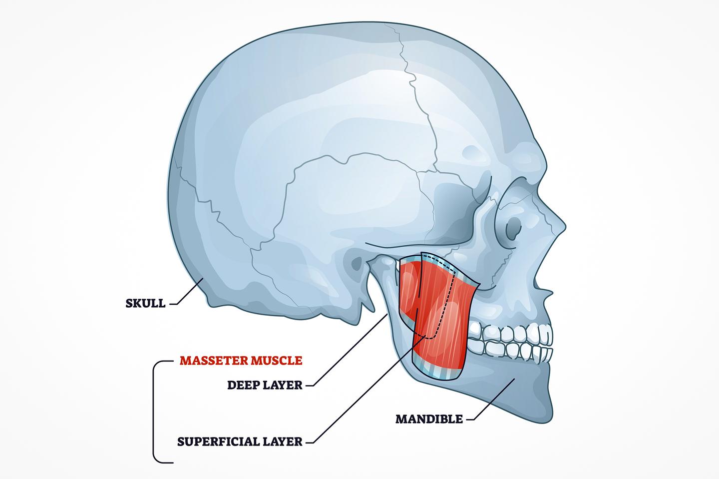 Prolonged musculoskeletal pain was induced by injecting a substance into the masseter muscle