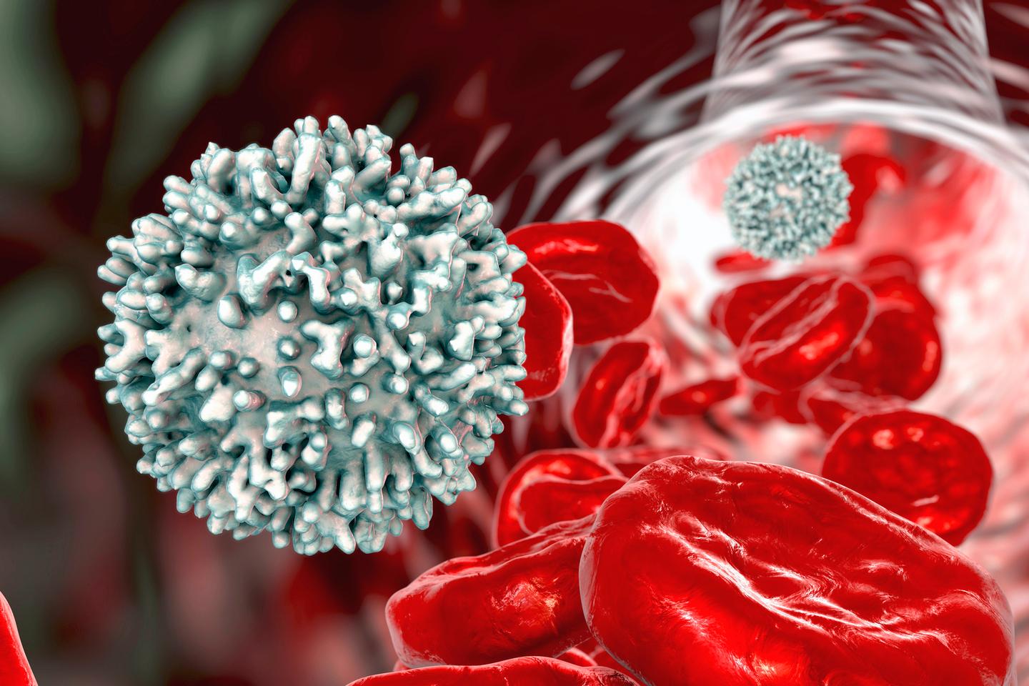 The study suggests T cells might have something to do with the development of Parkinson's