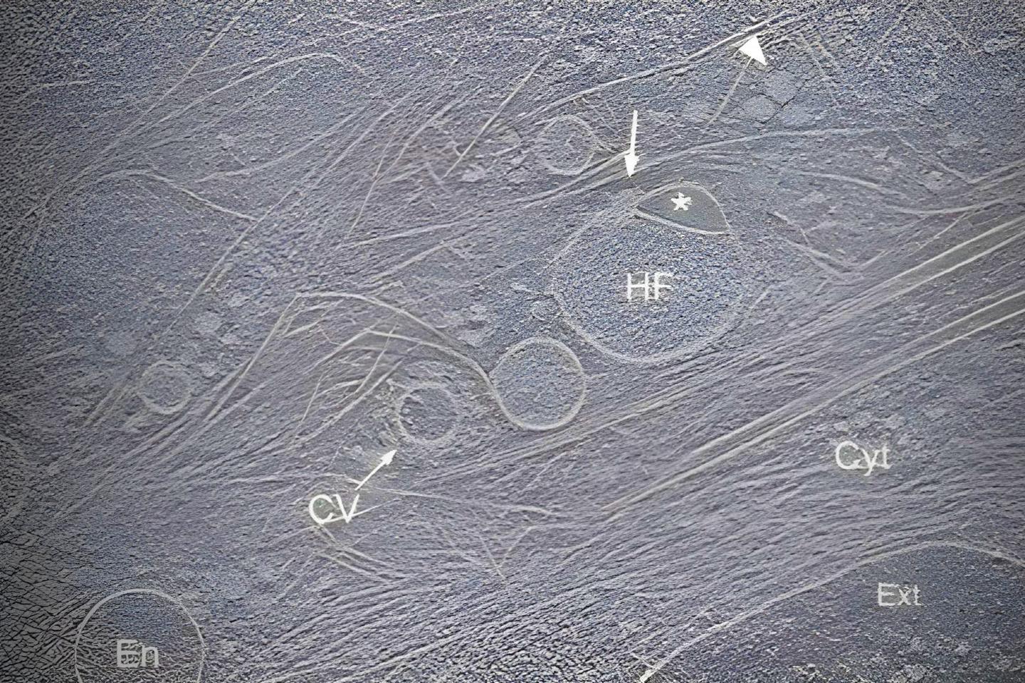 The newly discovered hemifusome, labeled "HF" in this cryo-electron tomography image