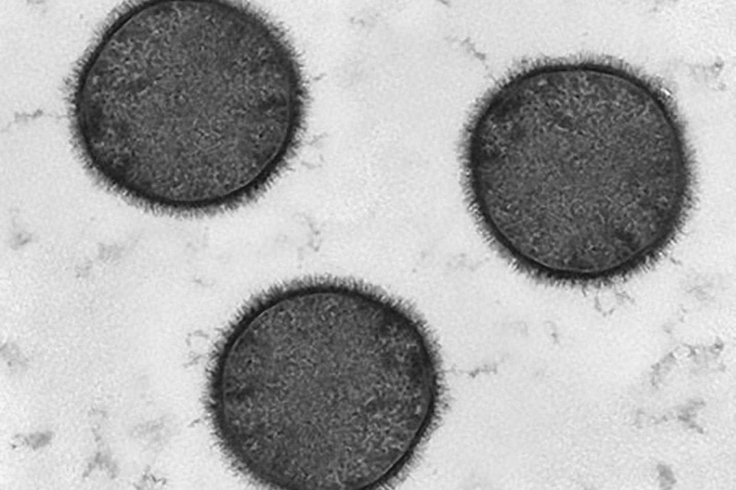 Microscopic image of cells showing the hair-like glycans on their surface